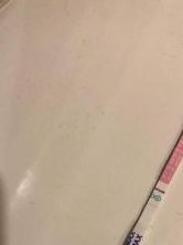 常州市第二人民医院洗精费用多少钱？试管婴儿移植成功后检查流程有哪些？