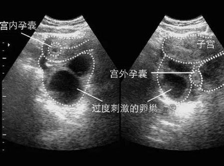 大连在哪里？大连哪些医院能做试管？